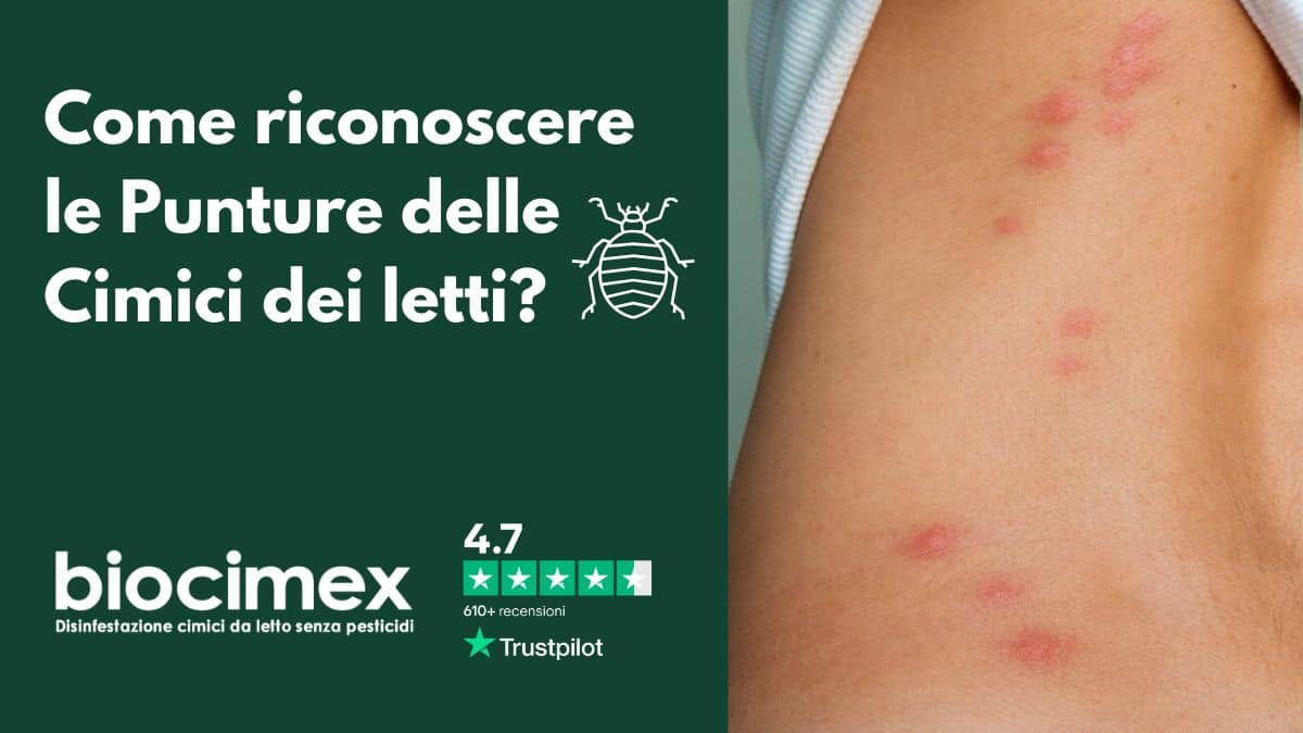 Punture di cimici dei letti disposte in fila sulla pelle